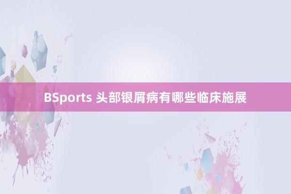 BSports 头部银屑病有哪些临床施展